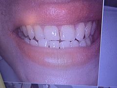 -土豆口腔(凤凰北总店)