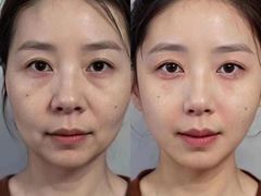 -雅世·合金公寓