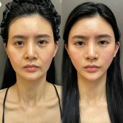 -Yestar 嘉兴艺星医疗美容医院