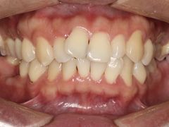 -齐玉齿科JADENTAL
