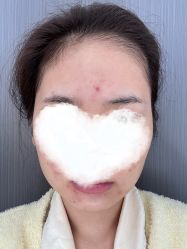 体验后-广州曙光医学美容医院