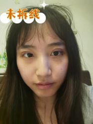 -素美医疗美容·西南眼鼻整形·修复基地