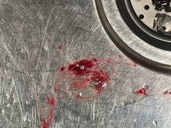 -杭州市第一人民医院(湖滨院区)