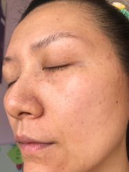 体验后-上海锦妍医疗美容门诊部