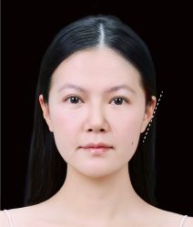 -Yestar艺星医疗美容医院