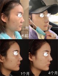 -北京米扬丽格医疗美容·联合丽格鼻整形中心