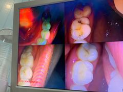 -土豆口腔(凤凰北总店)