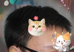 -大麦微针植发全国连锁