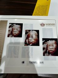 -郑州万安妇产医院