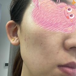 -联合丽格·张菡丽格医疗美容