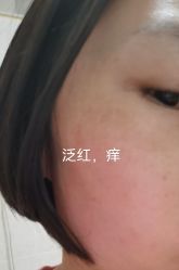 体验后-柒朵科技美肤中心
