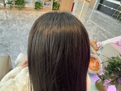 -碧莲盛·不剃发植发