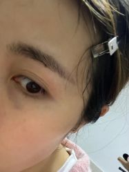 -杭州米兰柏羽医疗美容医院