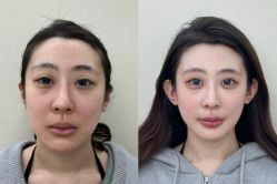 -上海伊莱美医疗美容医院