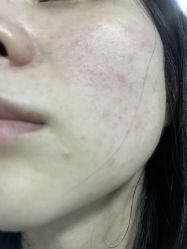 体验后-深圳美莱医疗美容医院