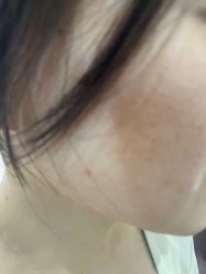 -广州美莱医疗美容医院