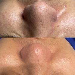 -Cream88颜皮肤管理中心