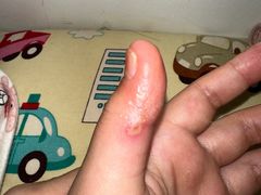 -广州市红十字会医院(总院)