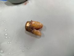 -爱贝口腔·牙周诊疗·种植修复中心