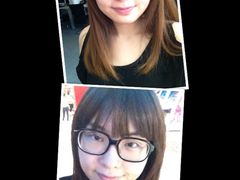 单眼皮和&nbsp;刚压好。。-上海华安整形外科门诊部