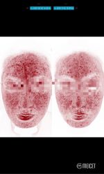 -靓芙泉专研痘痘肌