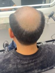 点击看大图 -唐风采假发补发定制