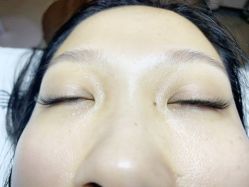 -韩静美科技护肤抗衰中心