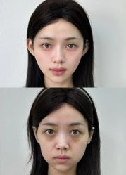 -宁波美莱整形美容