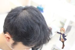 -大麦微针植发丨全国连锁