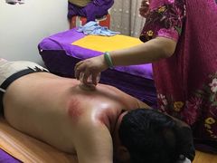 走罐-沈师傅盲人按摩工作室(密三小区店)