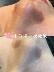 点击看大图 -Let's beauty莱恩轻奢皮肤管理