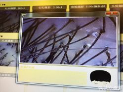 -菩叶头皮抗衰养发护发