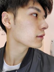 点击看大图 体验后-和颜一美轻医美连锁