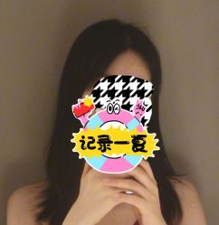 点击看大图 体验后-碧莲盛·不剃发植发