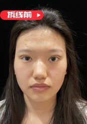 -素美医疗美容·西南眼鼻整形·修复基地