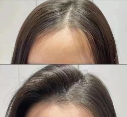 -GANO HAIR 