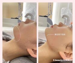 -E.beauty驻颜·痘敏肌调理中心