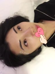 -美丽人生祛斑扁平疣汗管瘤中心