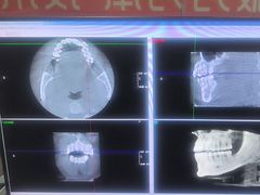 -土豆口腔(凤凰北总店)