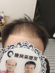 -唐风采假发补发定制