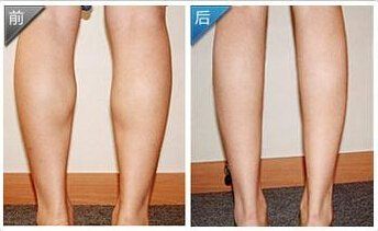 -广州美莱医疗美容医院