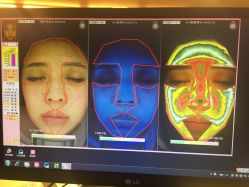 皮肤检测-光SPA科技美肤