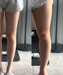 -Lily纤美·科技减脂中心