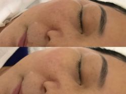 -Yukina Plus专业日式美肌