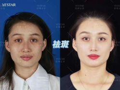-Yestar艺星医疗美容医院