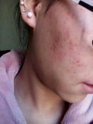 -MJ skin care国际皮肤管理中心