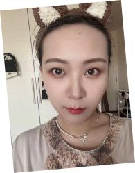 体验后-联合丽格·张菡丽格医疗美容