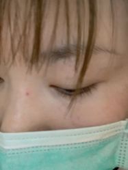 -新美荟医美·专注面部美学抗衰