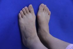 -圣嘉新医疗美容医院