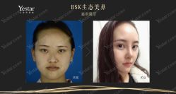 -Yestar艺星医疗美容医院